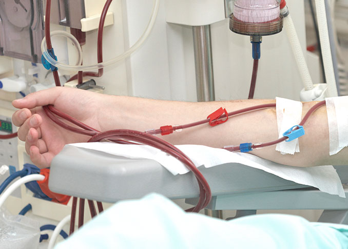Dialysis Market