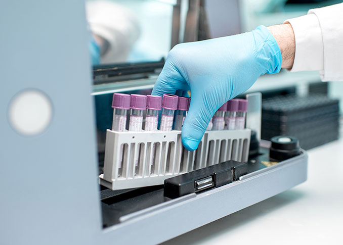 Hematology Analyzers