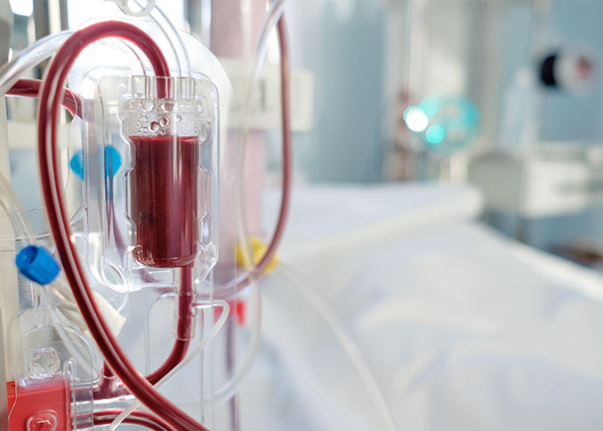 Hemodialysis