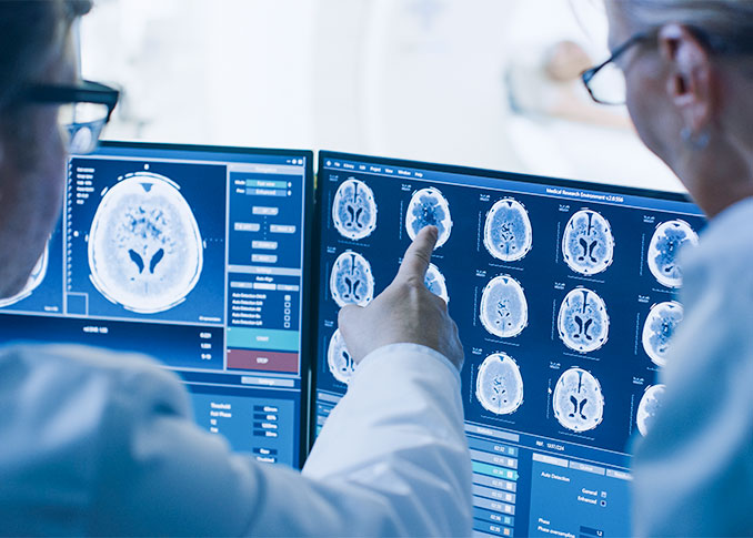 Neurovascular Market