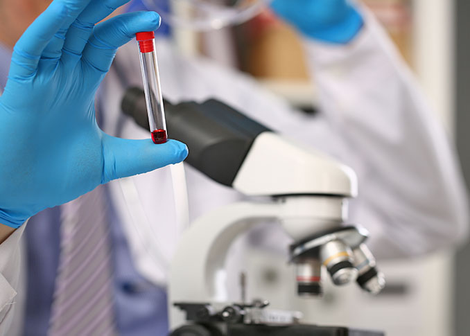 Therapeutic Apheresis