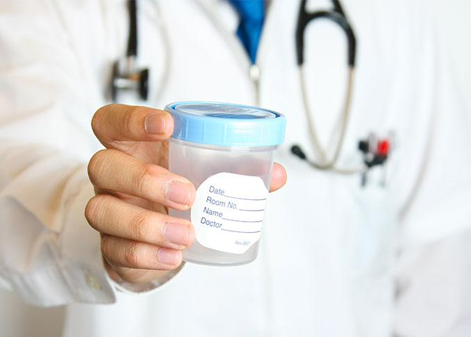 Urinalysis